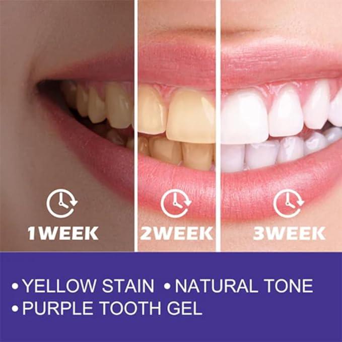 Purple Whitening Toothpaste - dunexemporium online store