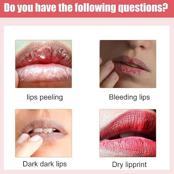 Lips Bleaching Cream Balm - dunexemporium online store