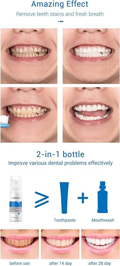 Teeth Whitening Mousse - dunexemporium online store